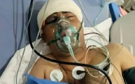 مسلحون في محافظة إب يعتدون على أحد الباعة بطريقة وحشية
