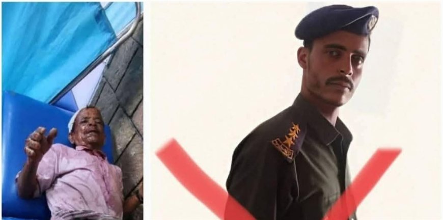إحراق بائع زلابيا مسن في سوق العدين على يد عنصر أمني حوثي