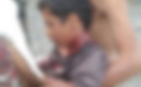 قناص حوثي يصطاد طفلًا داخل منزله بلحج