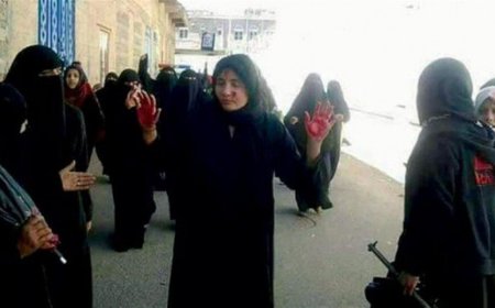 تقرير حقوقي يكشف عن إحصائية مروعة لضحايا العنف ضد النساء في المناطق الخاضعة للحوثيين