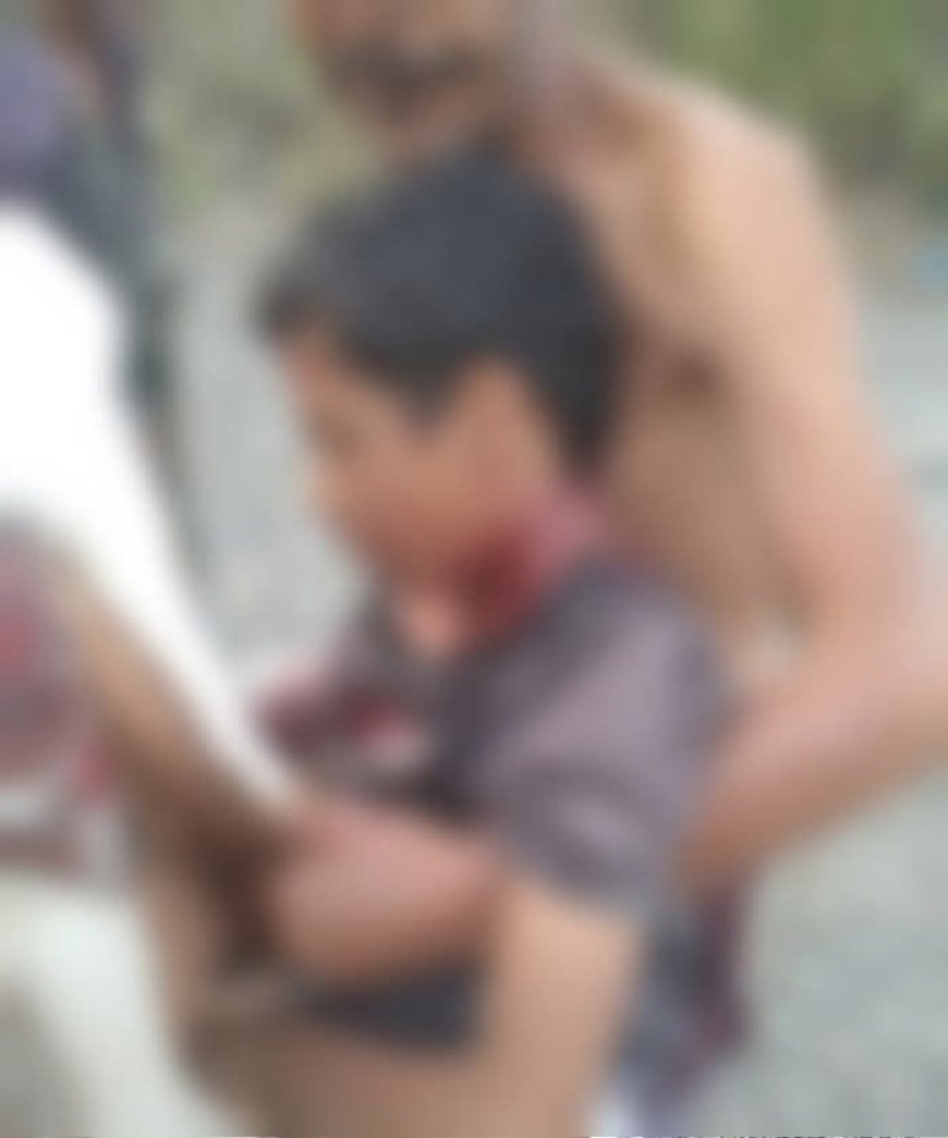 قناص حوثي يصطاد طفلًا داخل منزله بلحج