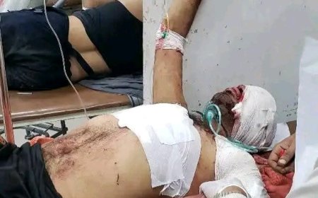 مقتل وإصابة 11 شخصًا إثر استهداف الحوثيين محطة وقود شمال تعز