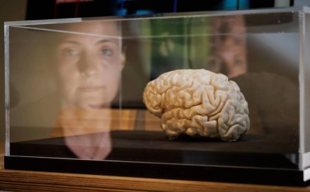 تحفيز كهربائي للدماغ يساعد من يعانون صعوبات تعلمية في الرياضيات