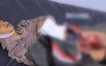 محور تعز: مقتل الأطفال في العرسوم سببه مقذوف حوثي قديم