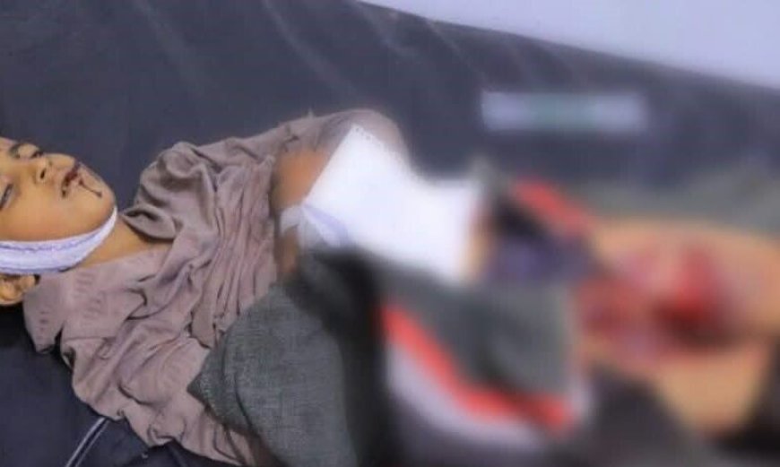 محور تعز: مقتل الأطفال في العرسوم سببه مقذوف حوثي قديم